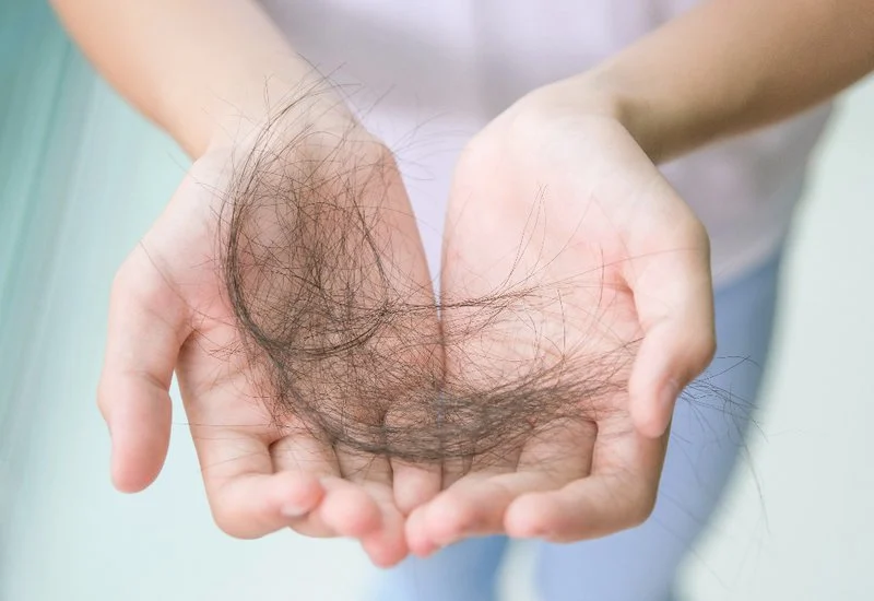 Rụng tóc là tác dụng phụ thường gặp của hóa trị trong điều trị ung thư.webp